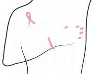 Παγκόσμια Ημέρα κατά του Καρκίνου του Μαστού: Δωρεάν εξετάσεις             και στοχευμένες δράσεις από το ΕΡΡΙΚΟΣ  ΝΤΥΝΑΝ Hospital Center