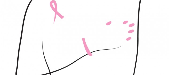 Παγκόσμια Ημέρα κατά του Καρκίνου του Μαστού: Δωρεάν εξετάσεις             και στοχευμένες δράσεις από το ΕΡΡΙΚΟΣ  ΝΤΥΝΑΝ Hospital Center