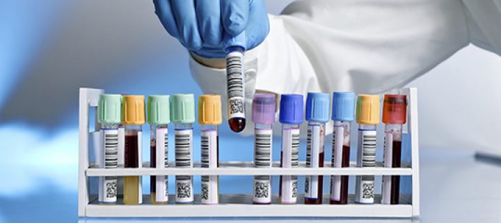 Πειραματικό τεστ αίματος μπορεί να ανιχνεύσει έγκαιρα τον καρκίνο