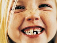 Κακή σύγκλειση των δοντιών: είναι θέμα γονιδίων ή φταίει κάτι που εμείς κάνουμε;