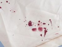 Μπορείς εύκολα να καθαρίσεις το λεκέ από αίμα