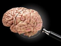 Τι είναι το Αστροκύτωμα Εγκεφάλου;
