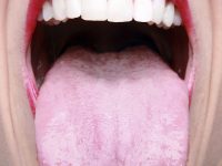 Ποια η σχέση του HPV  με τον καρκίνο του στόματος;