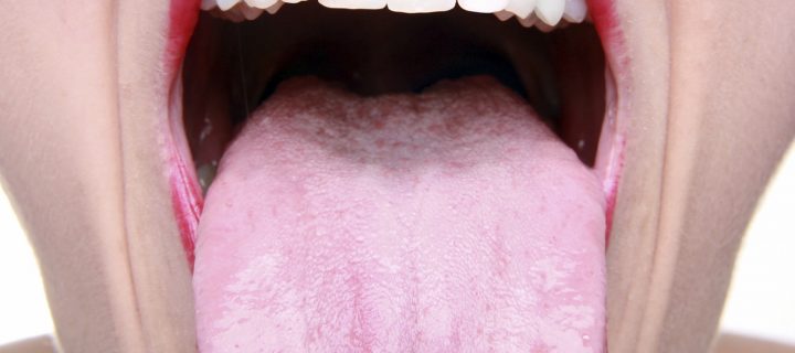 Ποια η σχέση του HPV  με τον καρκίνο του στόματος;