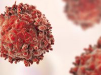 Έλληνες επιστήμονες ανακάλυψαν την πρωτεινή Chmp4c που εξοντώνει τα καρκινικά κύτταρα