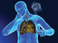Νέα δεδομένα αλλάζουν το «τοπίο» στην αντιμετώπιση του καρκίνου του πνεύμονα