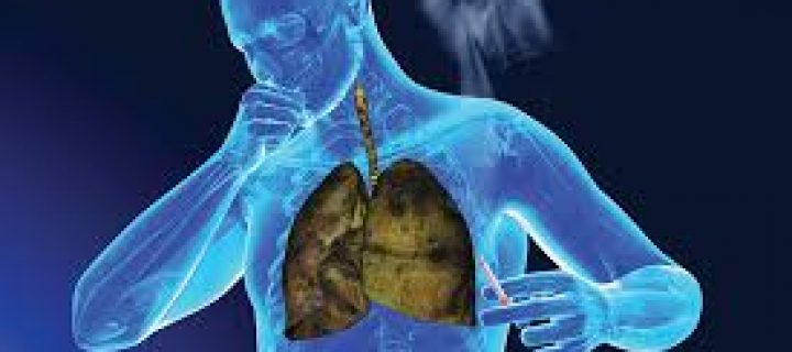 Νέα δεδομένα αλλάζουν το «τοπίο» στην αντιμετώπιση του καρκίνου του πνεύμονα