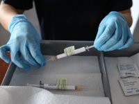 Συστάσεις του Εθνικού Οργανισμού Μεταμοσχεύσεων για τον Εμβολιασμό έναντι της covid19 ατόμων με Μεταμόσχευση Συμπαγών Οργάνων ή Αιμοποιητικών Κυττάρων