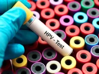 Εθνικό Πρόγραμμα για την Πρόληψη του Καρκίνου του Τραχήλου της Μήτρας: Ξεκίνησε η αποστολή των πρώτων SMS για δωρεάν test Pap